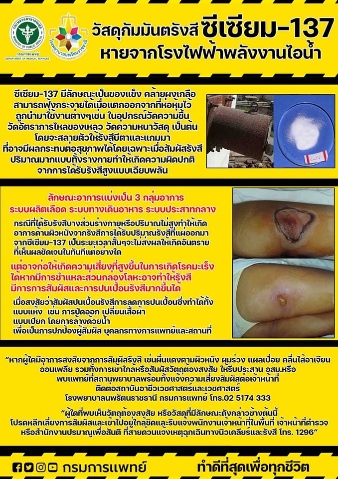 กรมการแพทย์_ซีเซียม 137